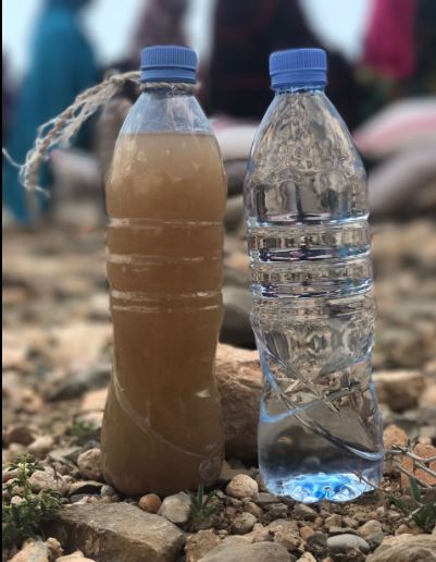 كارثة صحية هذه المياه التي يشربها أهلنا بالصومال